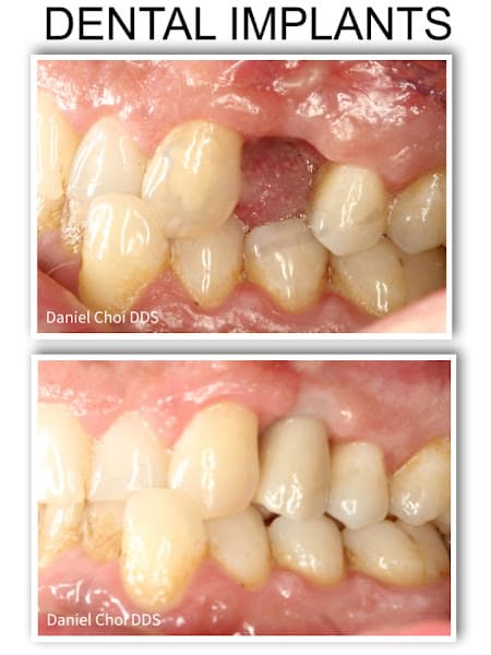 North Texas Dental Surgery Wisdom Teeth and Denture Implant Center — photo 2