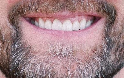 Idaho Dental Implants Lon C. McRae, DMD — photo 2