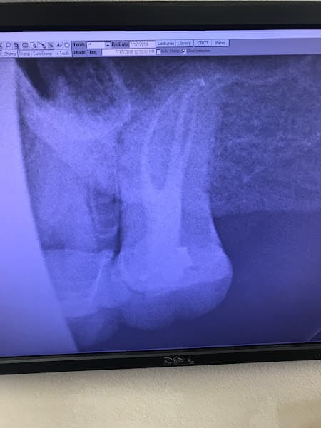 West Texas Endodontics — photo 3