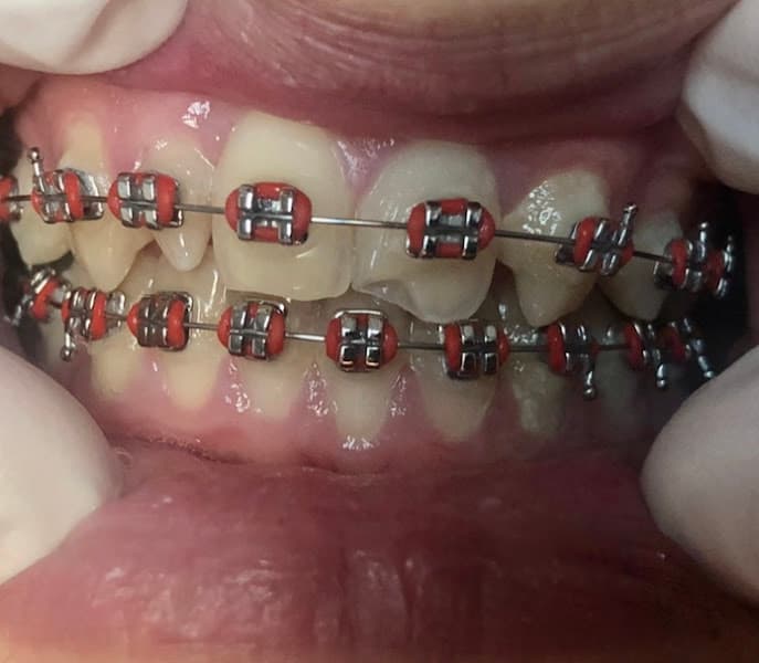 AZ Dental Club - Phoenix — photo 2