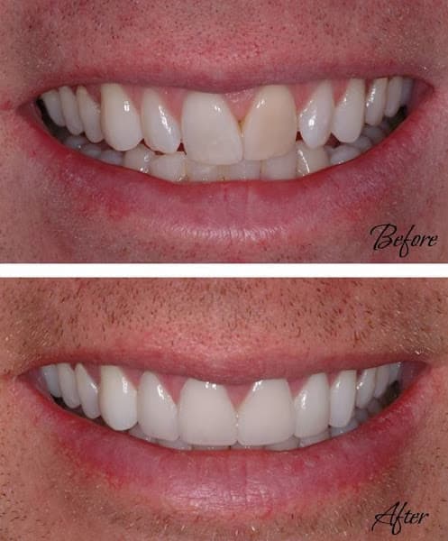 Mont Blanc Center For Dentistry — photo 2