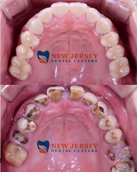 New Jersey Dental Centers — photo 2