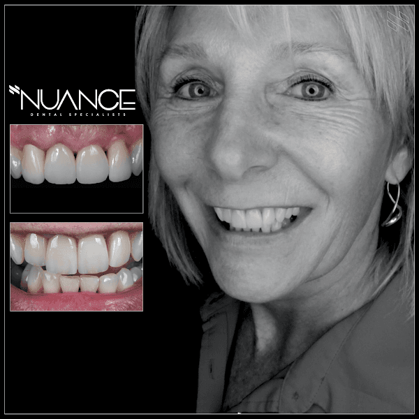 Nuance Dental Specialists — photo 2