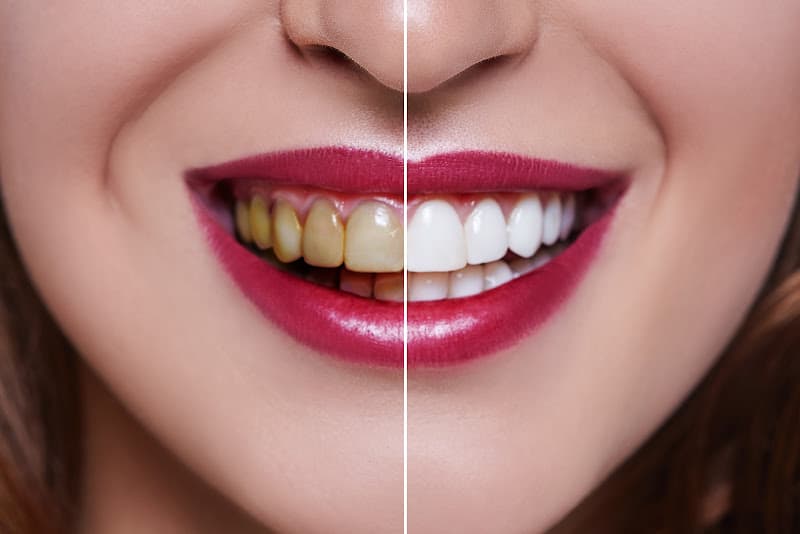 Sun Dental — photo 4