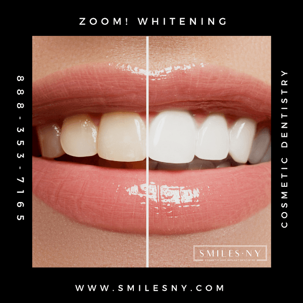 SmilesNY — photo 4