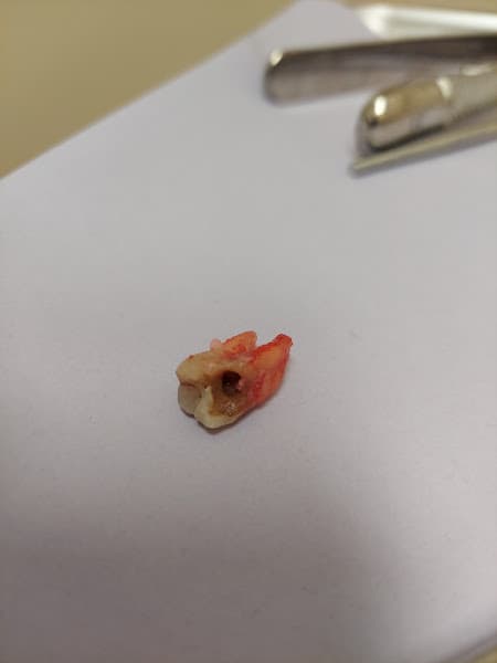 Aspen Dental — photo 2