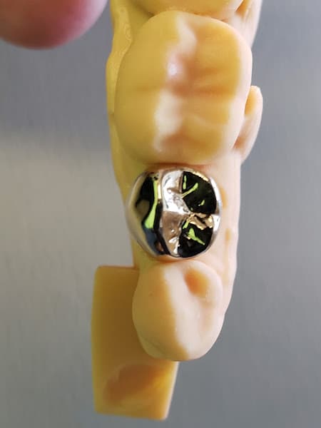 Eco Dental- He Harry Y DDS — photo 4