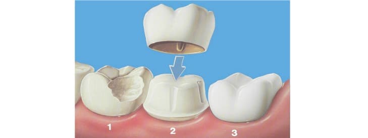 Smiline Dental Texas — photo 3