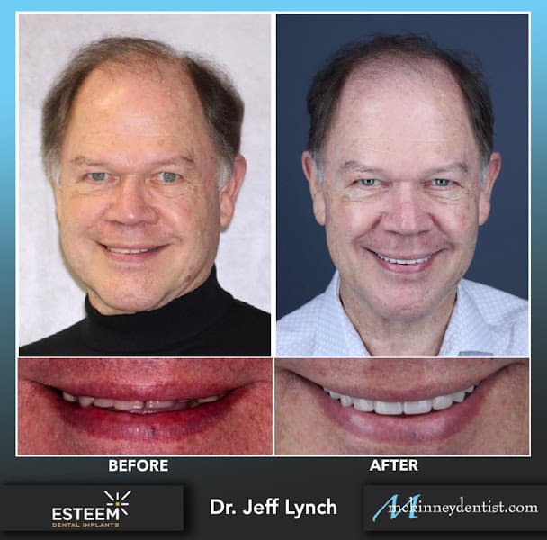Esteem Dental — photo 4