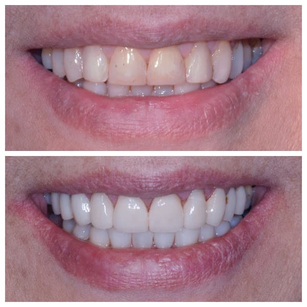 All Smiles Dentistry — photo 2