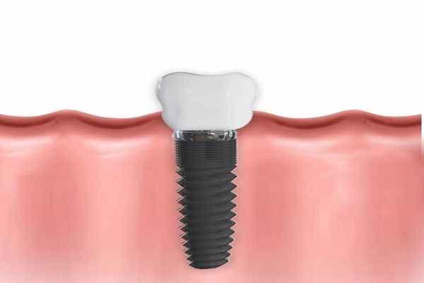 Pennsylvania Center for Dental Excellence — photo 2