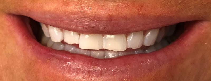 Dentistry of Poulsbo — photo 2