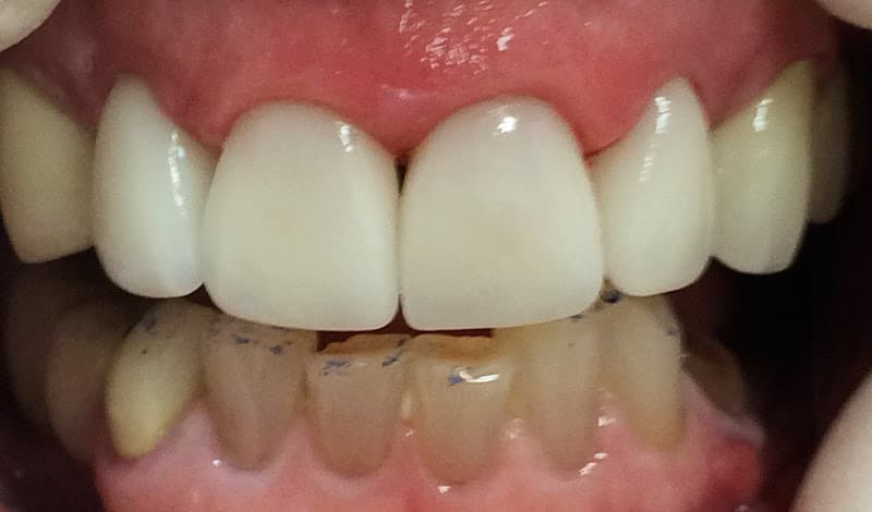 Double Diamond Dental: Michael A Morgan DDS — photo 3