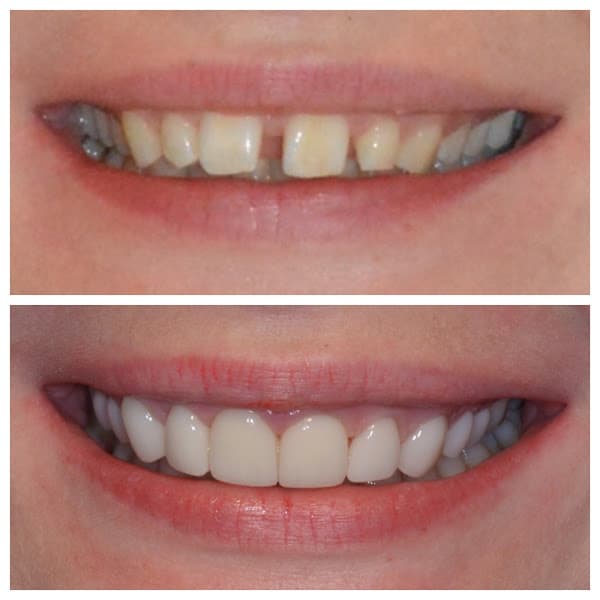 All Smiles Dentistry — photo 3