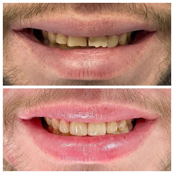 South Florida Dental Center of Coral Springs — photo 3