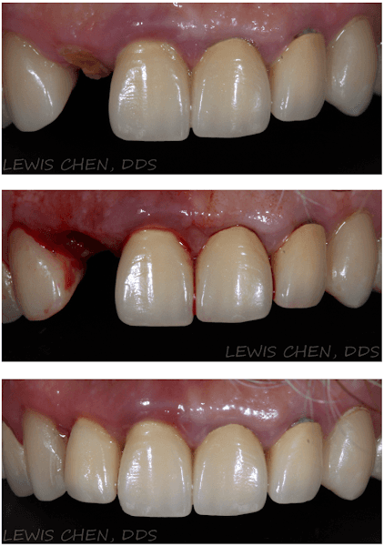 Ace Dental of New Jersey in West New York: General Dentistry, Implants, and Orthodontics — photo 2
