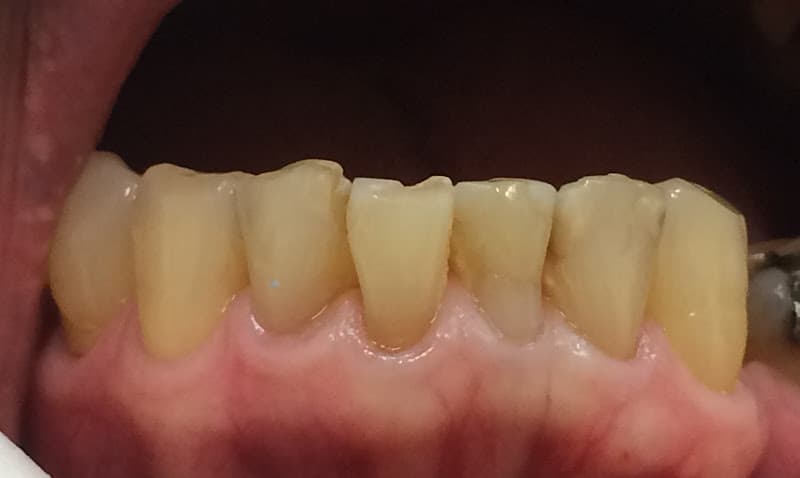 Double Diamond Dental: Michael A Morgan DDS — photo 2