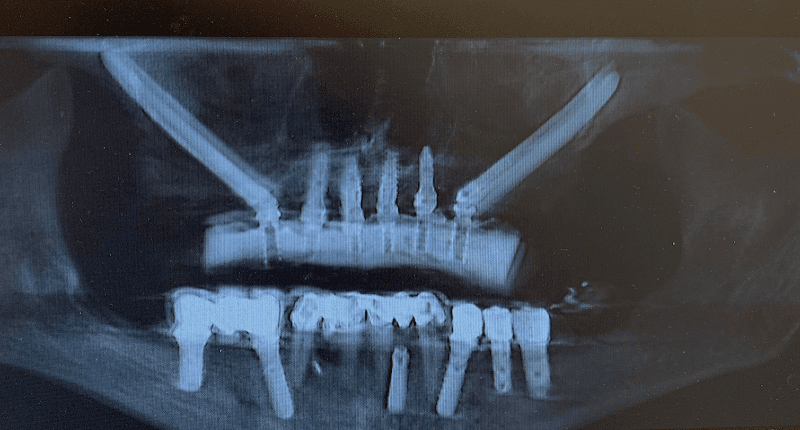 Texas Implant & Dental Center of Fort Worth — photo 4