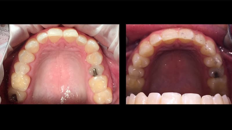 Ainsworth Family Dental- Dr McKenzie Owen — photo 2