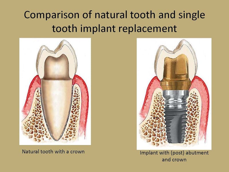 Meng Dentistry — photo 3