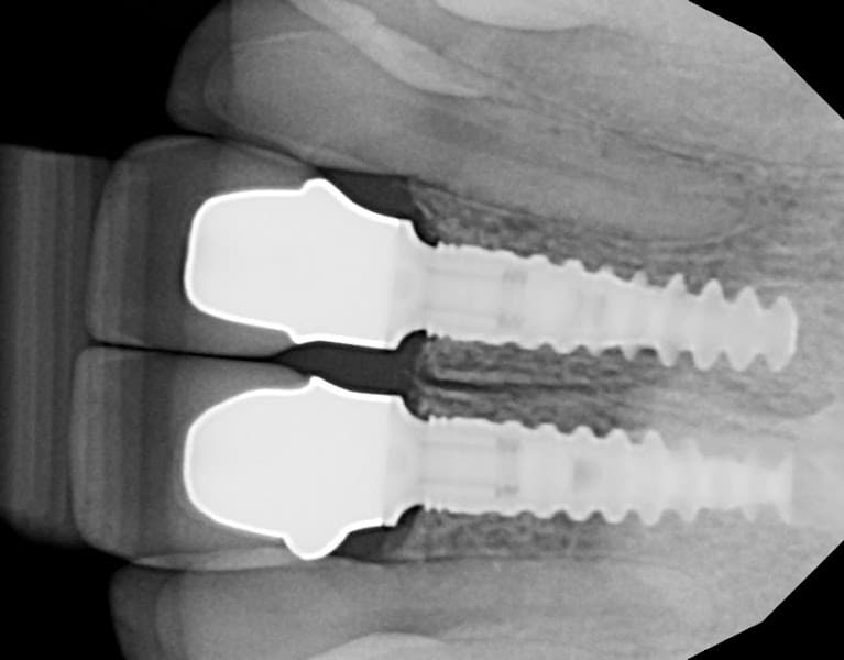 Idaho Dental Implants Lon C. McRae, DMD — photo 3