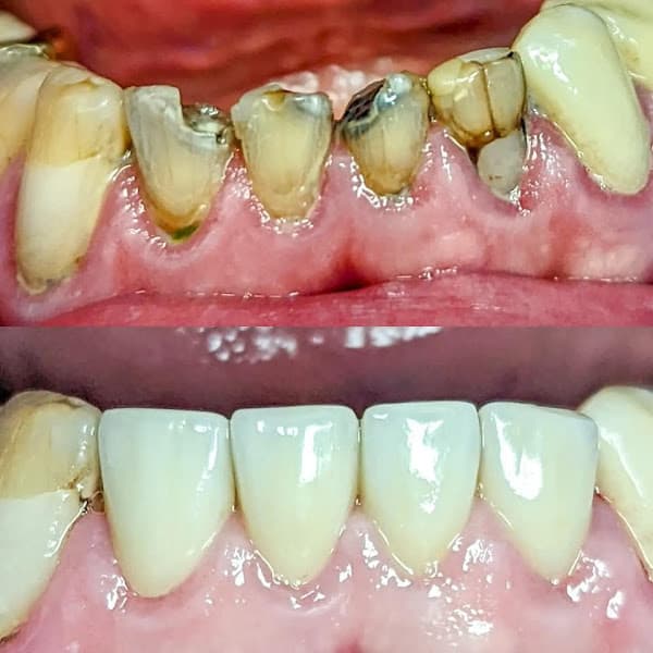 Northeast Lincoln Family Dentistry — photo 3