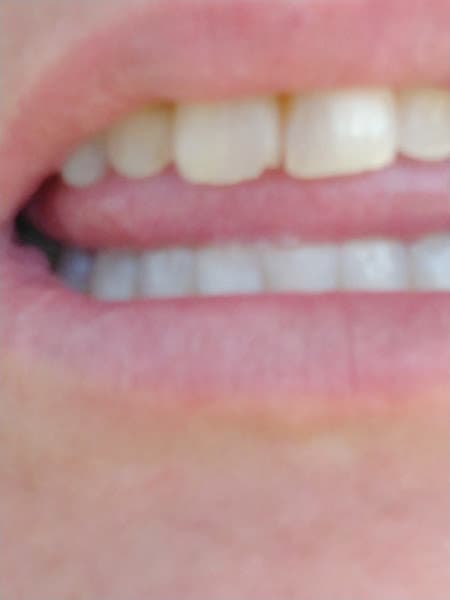 Family Dental Care Of New Castle — photo 2