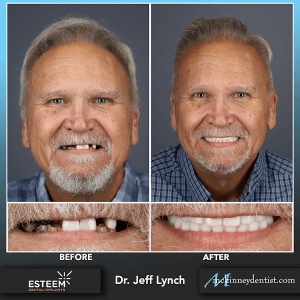 Esteem Dental — photo 3