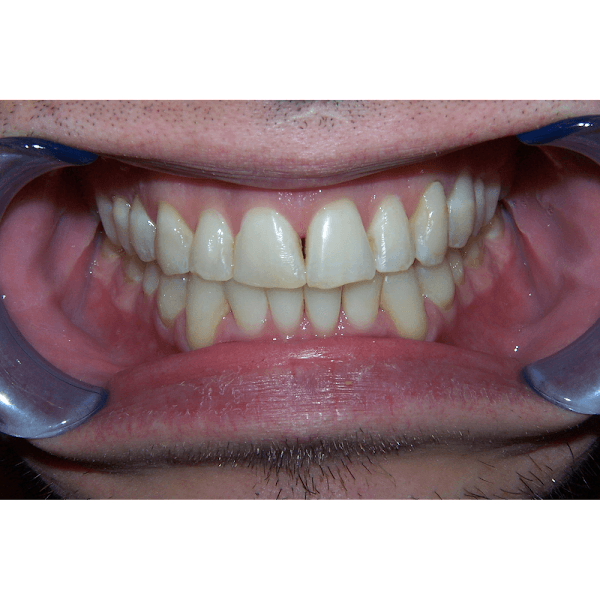 Dental Care Olathe — photo 2