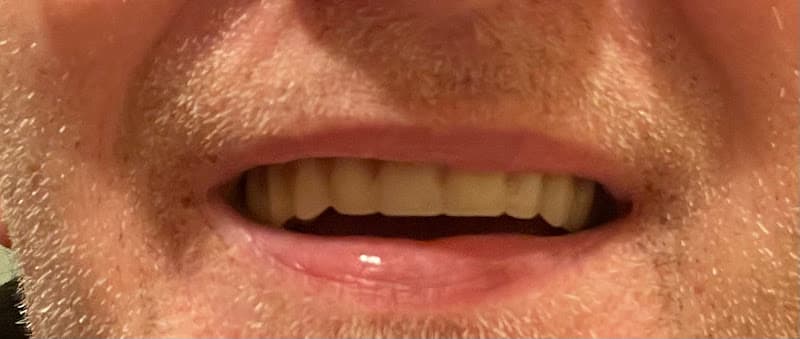 Penns Valley Dental Associates — photo 2