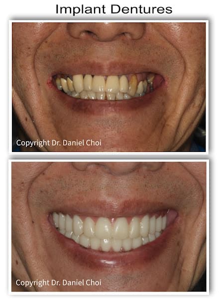 North Texas Dental Surgery Wisdom Teeth and Denture Implant Center — photo 4