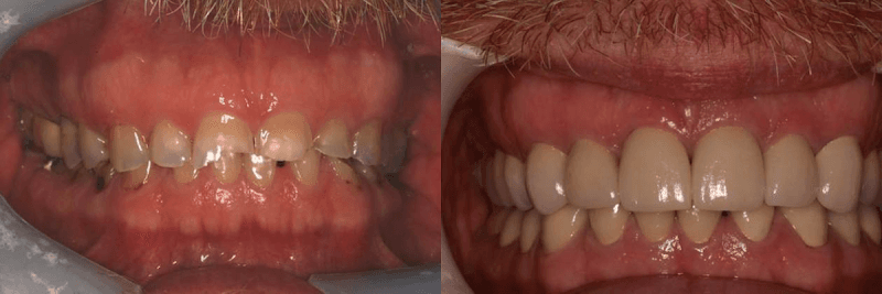 Advanced Dentistry of Connecticut — photo 3
