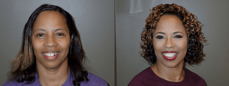 Batesville Dentistry — photo 4