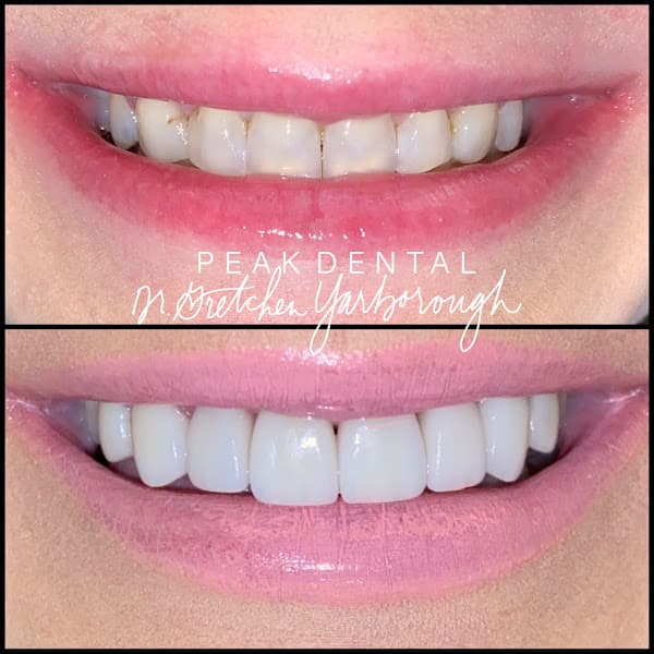 Peak Dental — photo 3