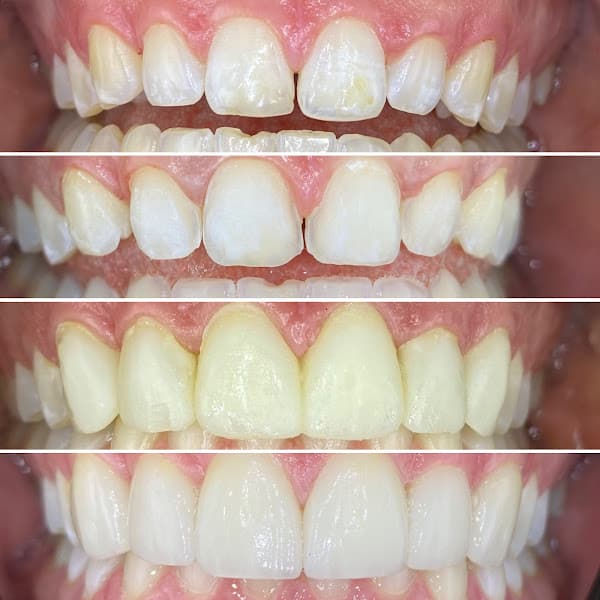 Dr Chip Webb - Top Arizona Cosmetic Dentist — photo 3