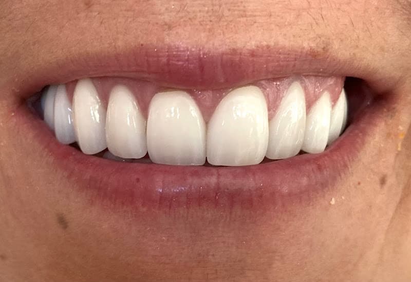 Utah Valley Dental — photo 2
