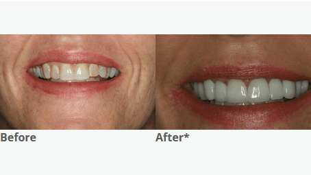 Advanced Dental Center of Florence — photo 4