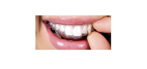 Young Family Dental Orem — photo 2