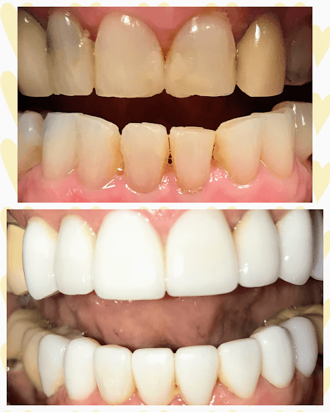 Downers Dental