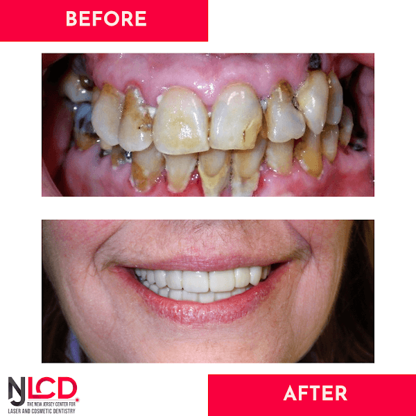 The New Jersey Center for Laser and Cosmetic Dentistry