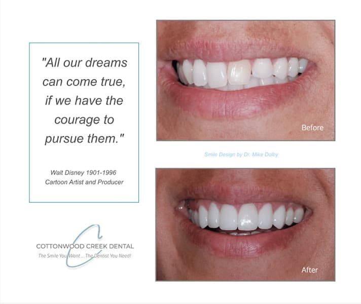 Cottonwood Creek Dental / Dr. Michael Dolby — photo 3