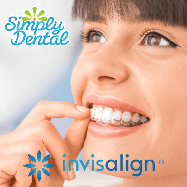 Simply Dental — photo 2