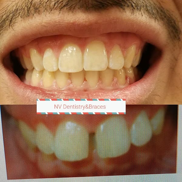 Nevada Dentistry & Braces — photo 4