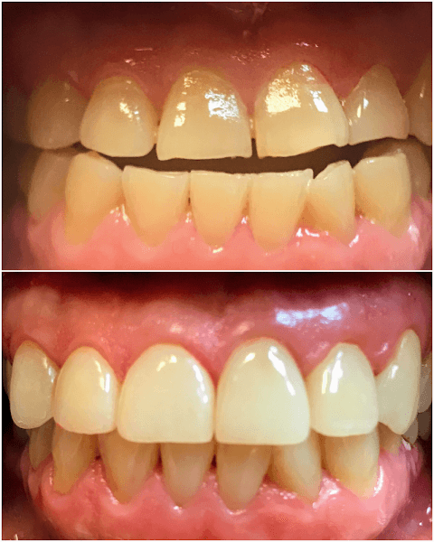 Downers Dental — photo 4