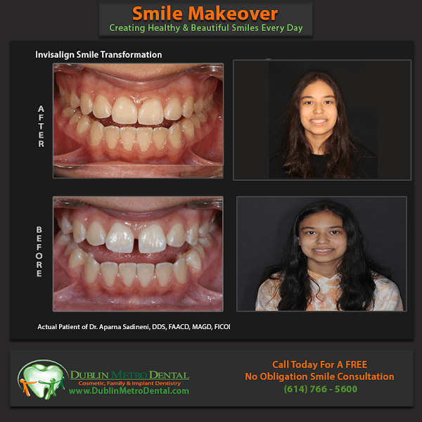 Dublin Metro Dental — photo 4