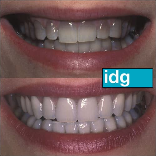 Iowa Dental Group - Des Moines — photo 4