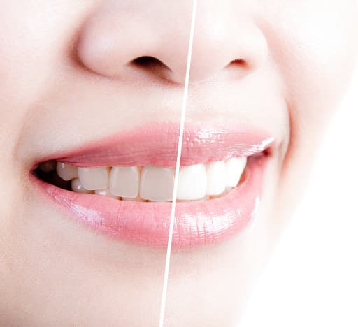 Evergreen Dental Care — photo 3