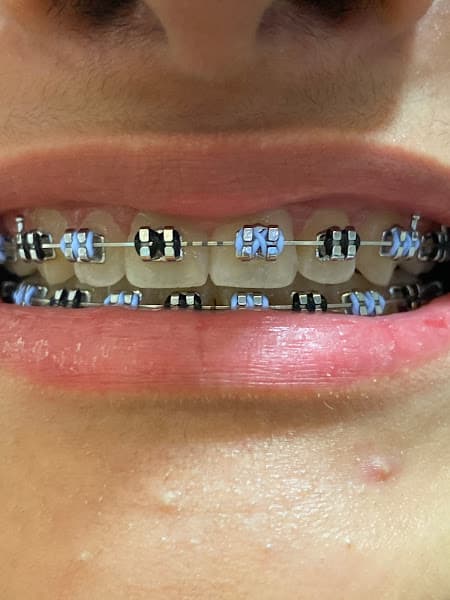 Elite Orthodontics - Falls Church — photo 4