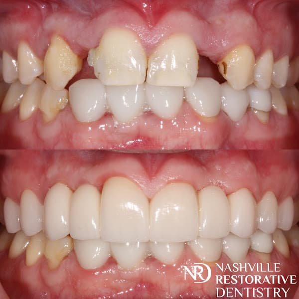 Nashville Restorative Dentistry — photo 2