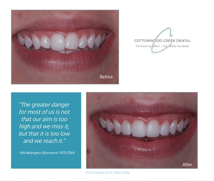 Cottonwood Creek Dental / Dr. Michael Dolby — photo 4